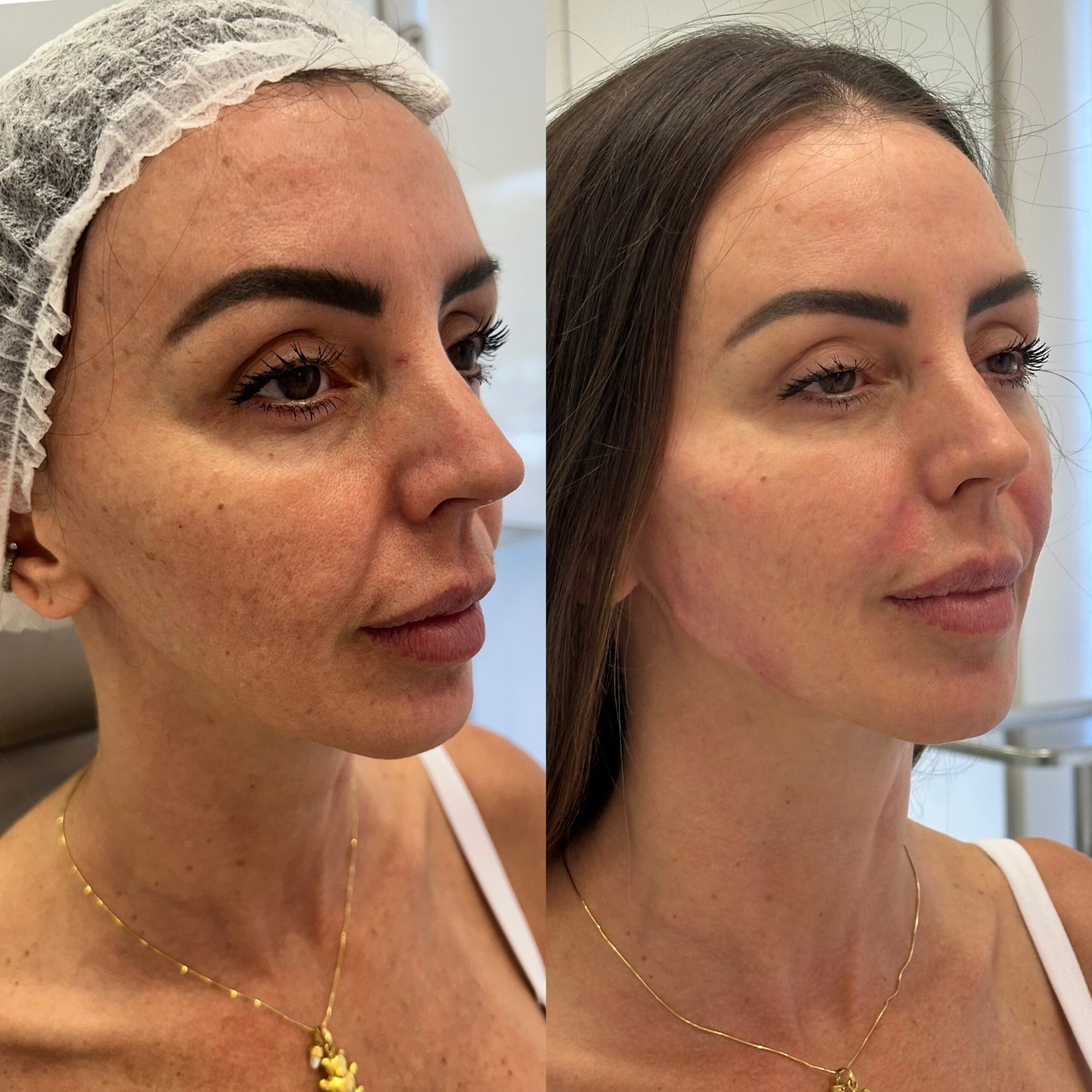 photo-output 3 Juliana